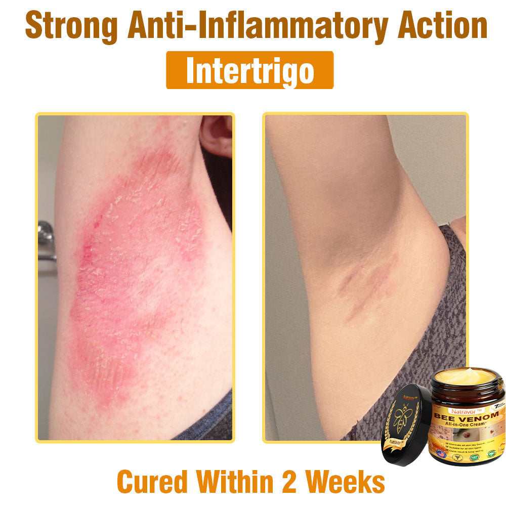 Natravor™ Bee Venom All-in-One Cream US Dermatologist Approved