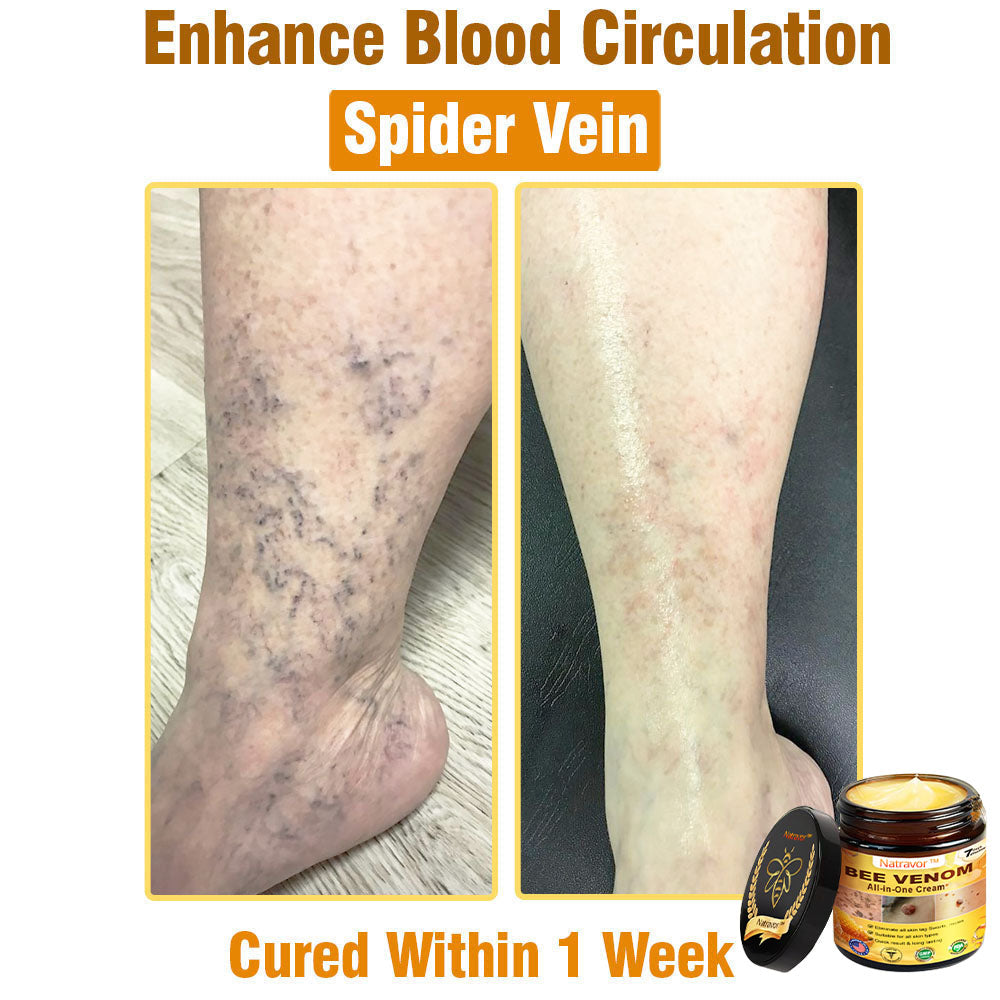 Natravor™ Bee Venom All-in-One Cream US Dermatologist Approved