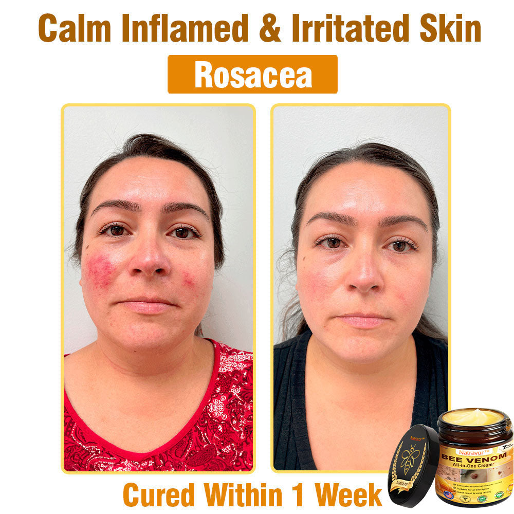 Natravor™ Bee Venom All-in-One Cream US Dermatologist Approved