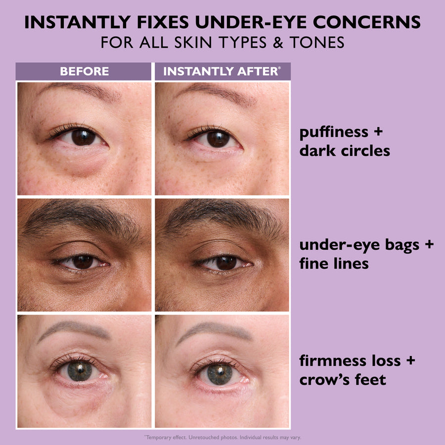 Last 3 Hours:đ„ Up to 15% OFF â Instant Eye Tightener Easy-Wear Formula