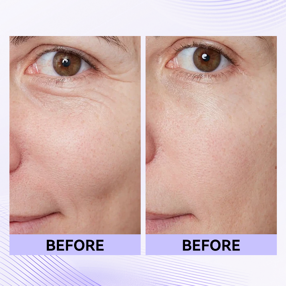 Last 3 Hours:đ„ Up to 15% OFF â Instant Eye Tightener Easy-Wear Formula