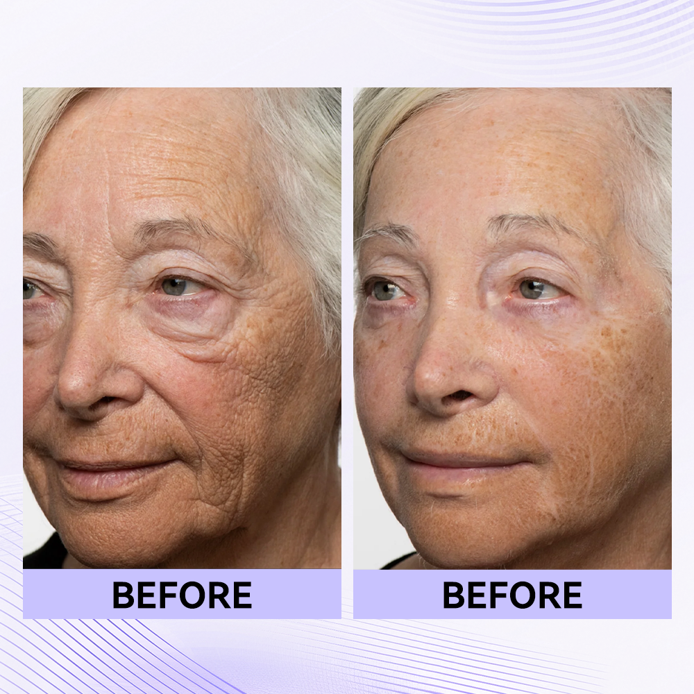 Last 3 Hours:đ„ Up to 15% OFF â Instant Eye Tightener Easy-Wear Formula