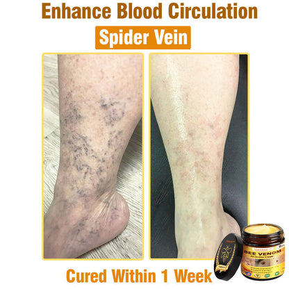 Natravor™ Bee Venom All-in-One Cream US Dermatologist Approved