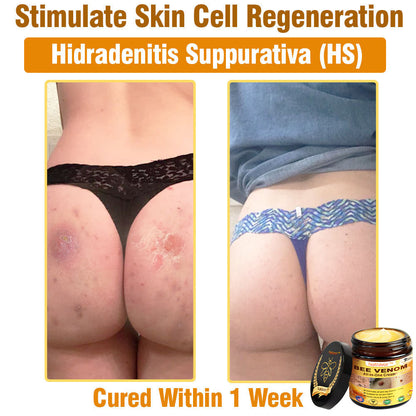 Natravor™ Bee Venom All-in-One Cream US Dermatologist Approved