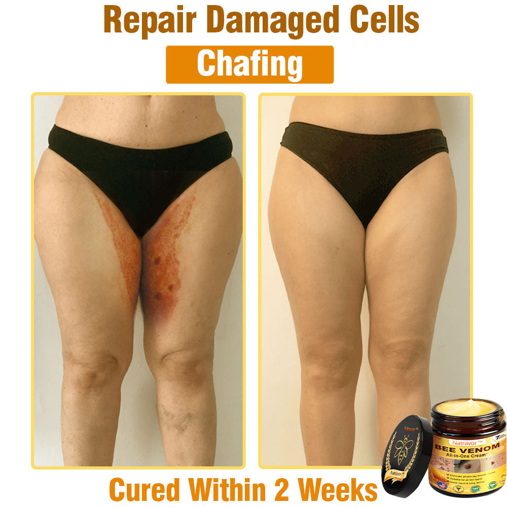 Natravor™ Bee Venom All-in-One Cream US Dermatologist Approved