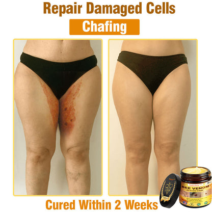 Natravor™ Bee Venom All-in-One Cream US Dermatologist Approved