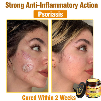 Natravor™ Bee Venom All-in-One Cream US Dermatologist Approved