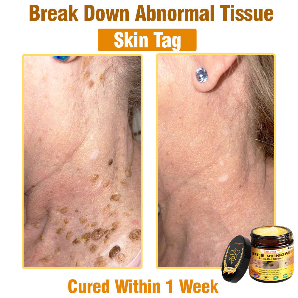 Natravor™ Bee Venom All-in-One Cream US Dermatologist Approved