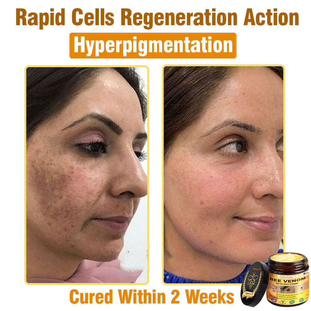 Natravor™ Bee Venom All-in-One Cream US Dermatologist Approved