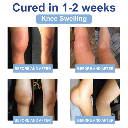 ✅𝐌𝐚𝐲𝐨 𝐂𝐥𝐢𝐧𝐢𝐜 𝐎𝐟𝐟𝐢𝐜𝐢𝐚𝐥: Natravor® Magnesium pain relief healing cream  (Treatment for arthritis, neuropathyy, rheumatic diseases, muscle spasms, twitches and sports injuries )