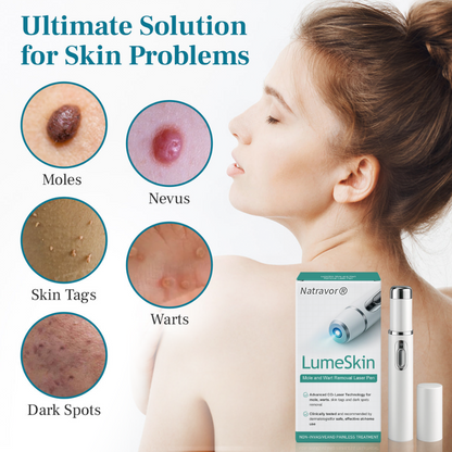 Natravor® LumeSkin Mole and Wart Removal Laser Pen